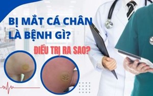 BỊ MẮT CÁ CHÂN LÀ BỆNH GÌ? ĐIỀU TRỊ RA SAO?